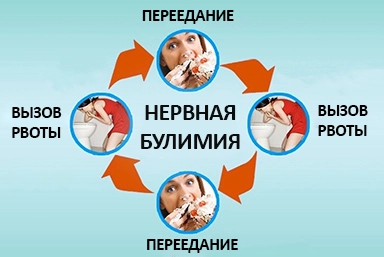 Лечение булимии в Алматы